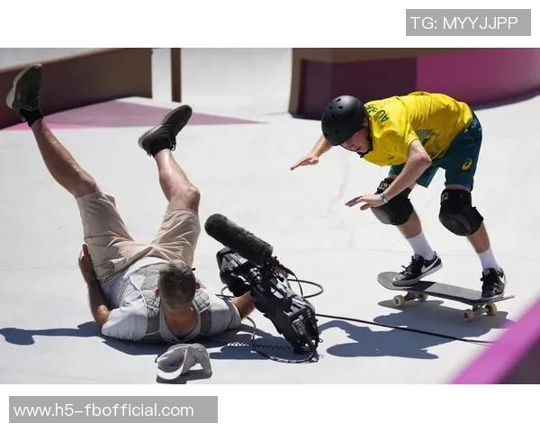 帕尔默家中意外受伤左脚小脚趾撞门引发关注